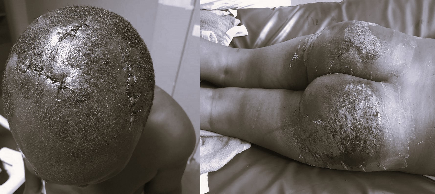 Jackson Twinamasiko's worker was beaten by Major Mark Wanyama and the team.