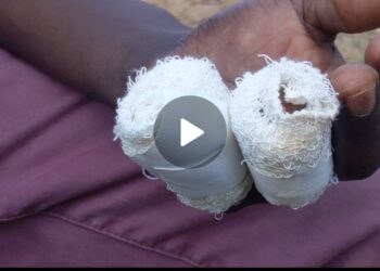 Machine Cutoff Operator’s Fingers at Quality Plastics Factory