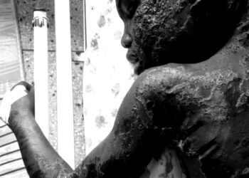 Twelve-year-old suffering with wounds