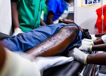 Bobi Wine Knocked Himself On Vehicle Door-Police