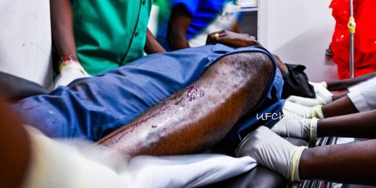 Bobi Wine Knocked Himself On Vehicle Door-Police