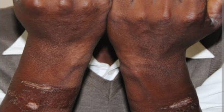 Torture Case of Hellen Judith Baliraine Takes a Controversial Turn