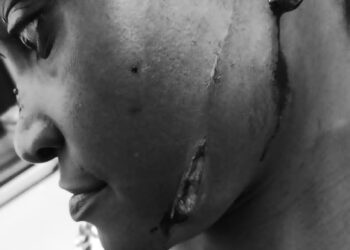 Father Allegedly Attacks Daughter in Escalating Political, Land Dispute