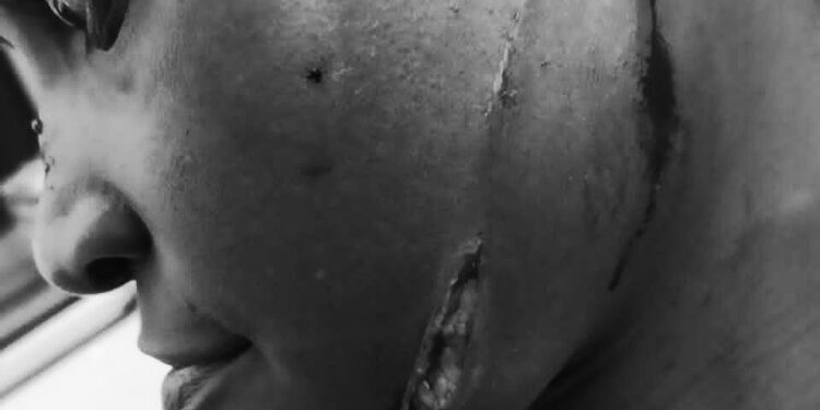 Father Allegedly Attacks Daughter in Escalating Political, Land Dispute