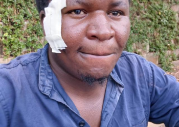 Journalist Assaulted While Investigating Absenteeism at Police Station