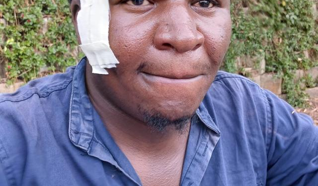 Journalist Assaulted While Investigating Absenteeism at Police Station